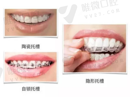奥齿泰种植牙优缺点（奥齿泰质保几年）(图1)